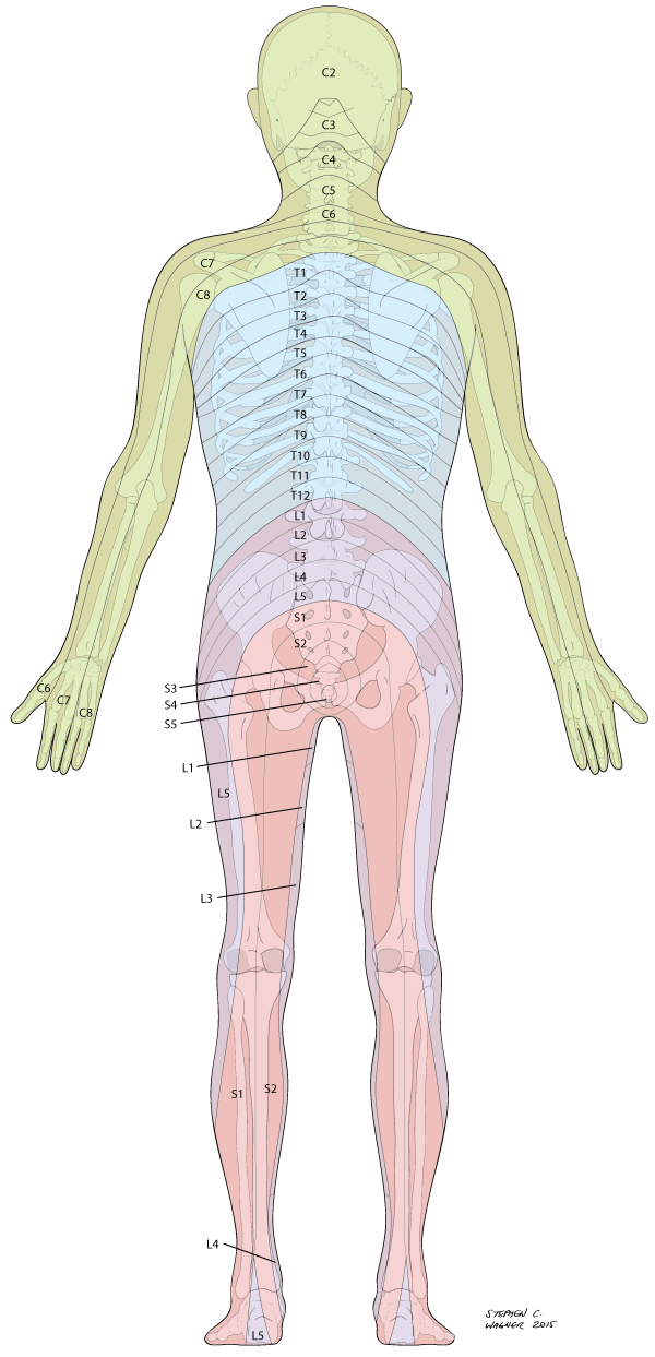 posterior-dermatomal-cx-lx-pain