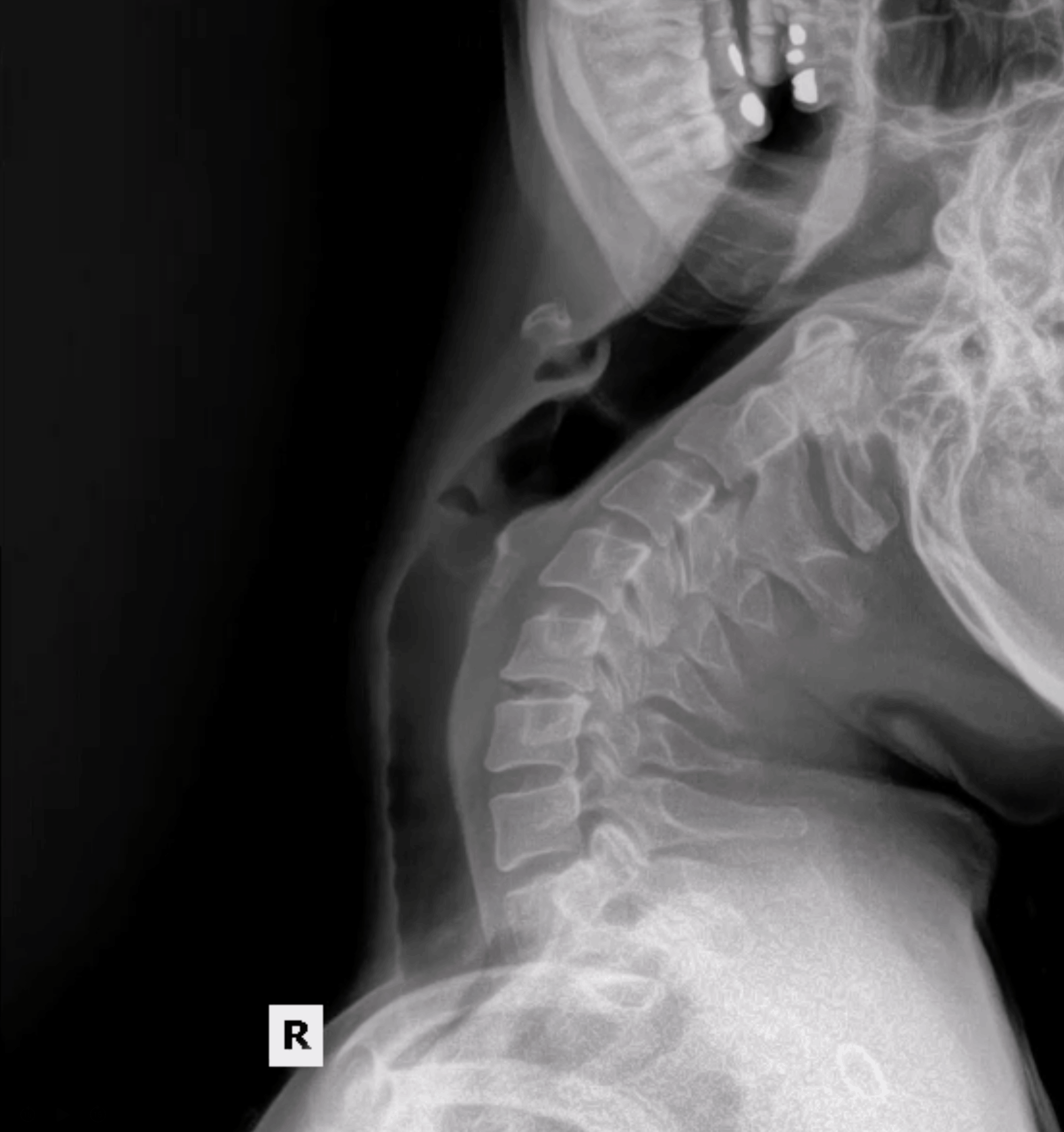Motion Radiography Dynamic Digital Radiography (DDR) in Portland: Advanced Motion X-Ray ...