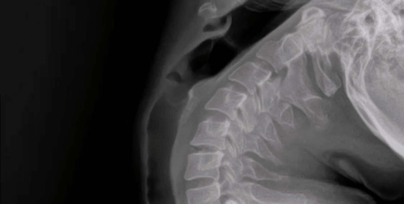Dynamic Digital Radiography (DDR) in Portland: Advanced Motion X-Ray ...